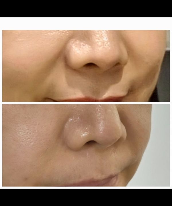 もっと若くなりましたので気持ちがいいです