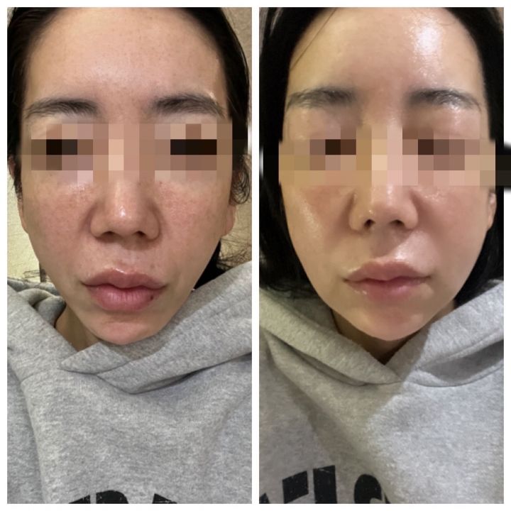 全体的に顔がふっくらしました