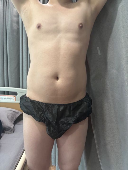 手術前